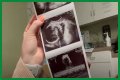 Counting On Alum Joy-Anna Forsyth Updates At 33 Weeks Pregnant