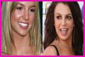 What’s Up with Britney Spears’ Smile? The Scoop on Her Noticeable Gap Teeth